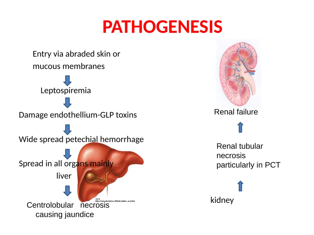 Leptospirosis is a bacterial disease that affects - slide 11 of 28