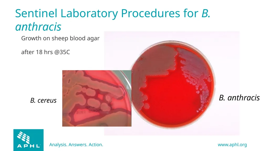 Agents of Bioterrorism Bacillus anthracis: Anthrax - slide 17 of 30