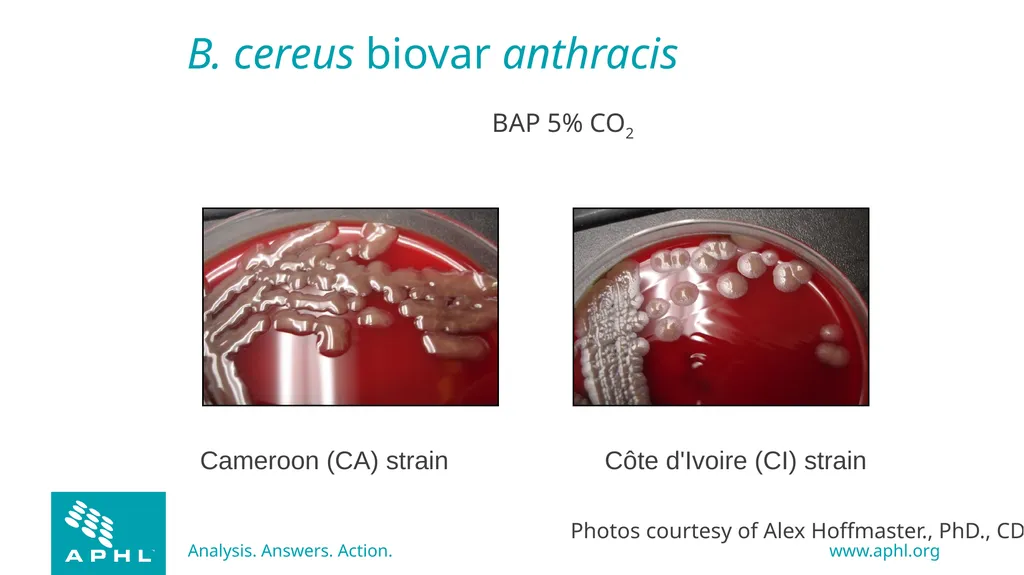 Agents of Bioterrorism Bacillus anthracis: Anthrax - slide 27 of 30