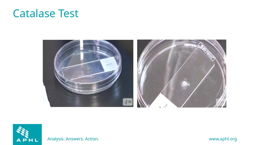 Agents of Bioterrorism Bacillus anthracis: Anthrax - slide 21 of 30