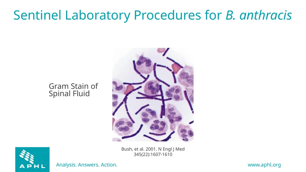 Agents of Bioterrorism Bacillus anthracis: Anthrax - slide 9 of 30