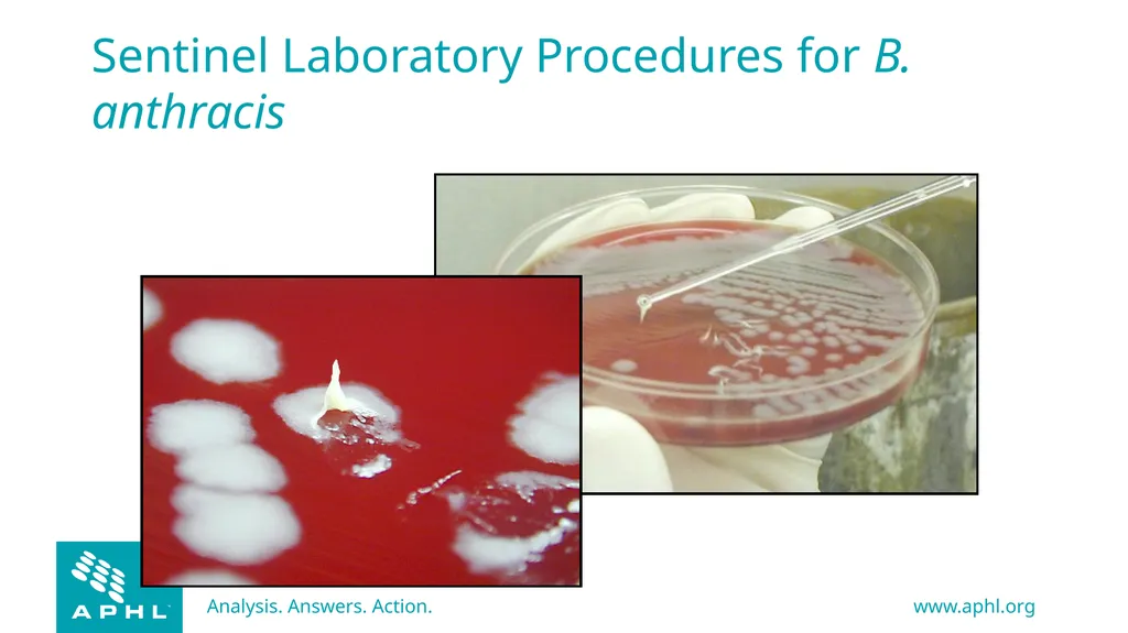 Agents of Bioterrorism Bacillus anthracis: Anthrax - slide 16 of 30