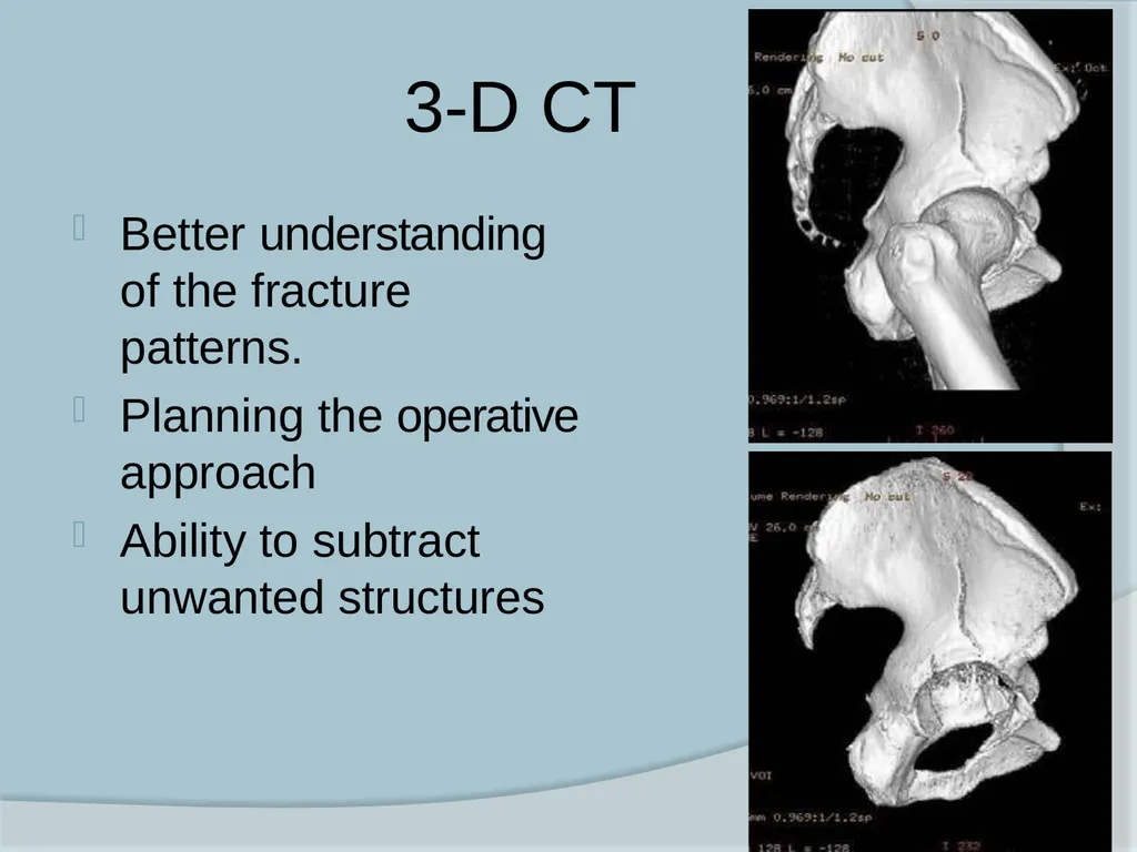 Dr. Irfan Hussain ( Assistant Professor) - slide 34 of 85