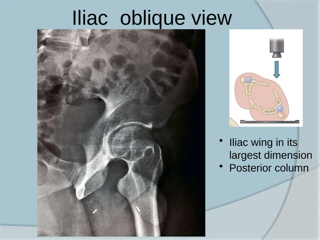 Dr. Irfan Hussain ( Assistant Professor) - slide 31 of 85