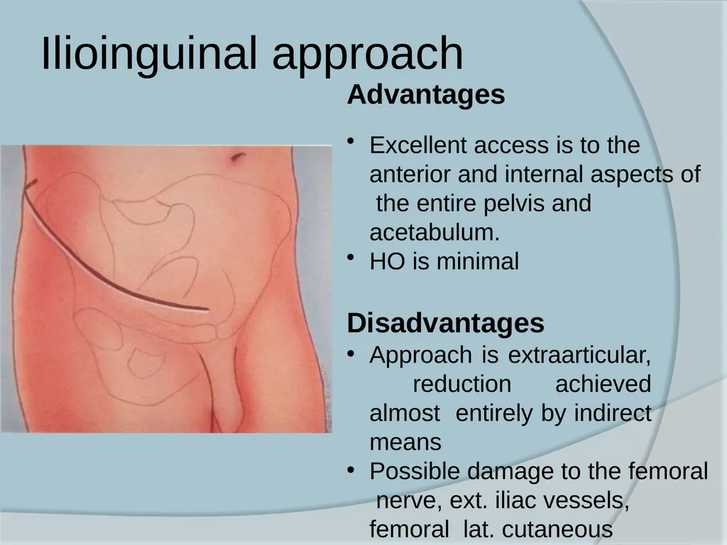 Dr. Irfan Hussain ( Assistant Professor) - slide 58 of 85