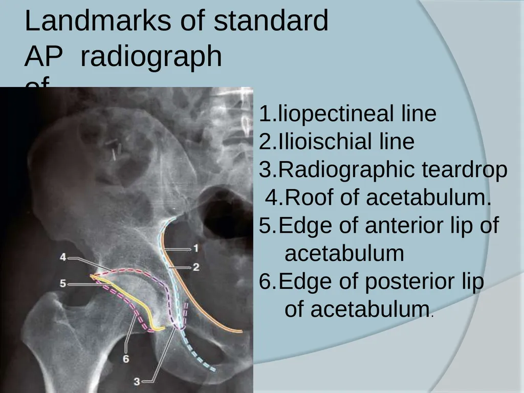 Dr. Irfan Hussain ( Assistant Professor) - slide 28 of 85