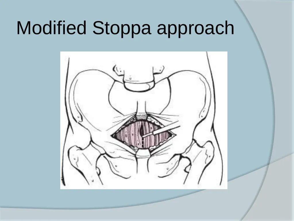 Dr. Irfan Hussain ( Assistant Professor) - slide 62 of 85