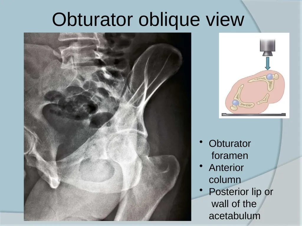 Dr. Irfan Hussain ( Assistant Professor) - slide 30 of 85