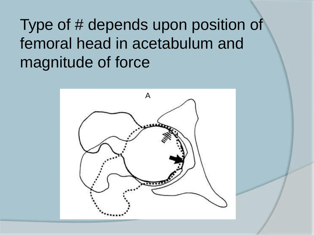 Dr. Irfan Hussain ( Assistant Professor) - slide 24 of 85