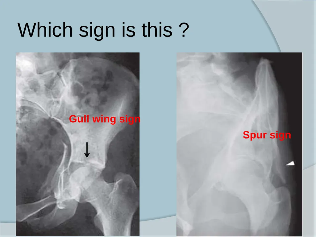 Dr. Irfan Hussain ( Assistant Professor) - slide 83 of 85