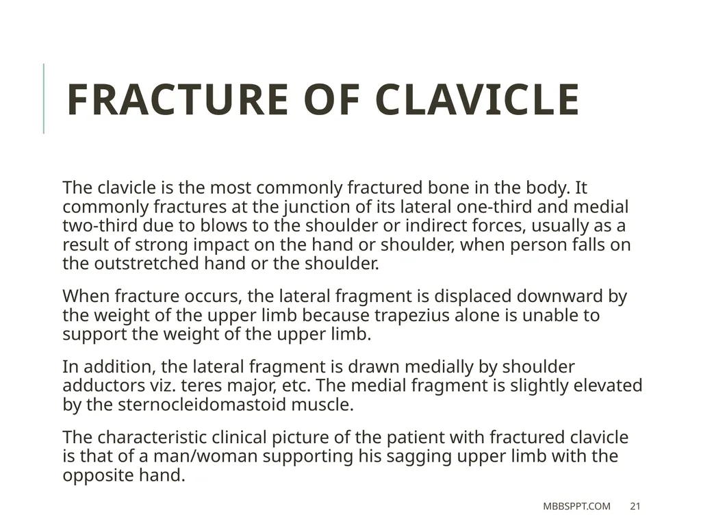 The clavicle (collar bone) BY MBBSPPT.COM The - slide 21 of 26