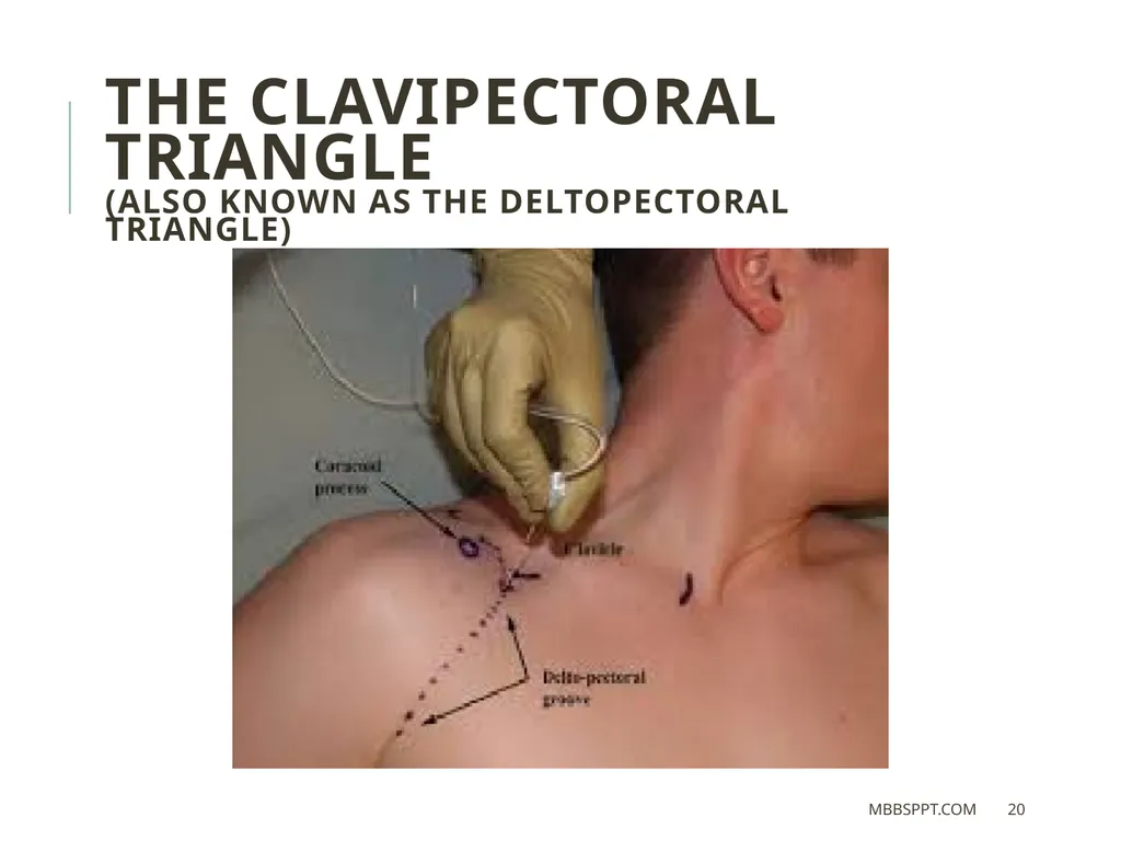 The clavicle (collar bone) BY MBBSPPT.COM The - slide 20 of 26