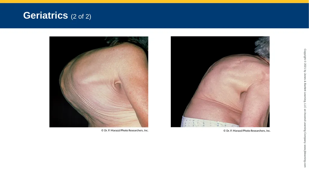 CHAPTER 8 Lifting and Moving Patients National EMS - slide 53 of 101