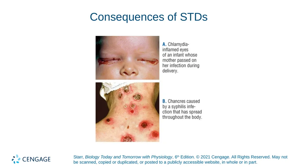 Chapter 27 Animal Reproduction and Development - slide 57 of 58