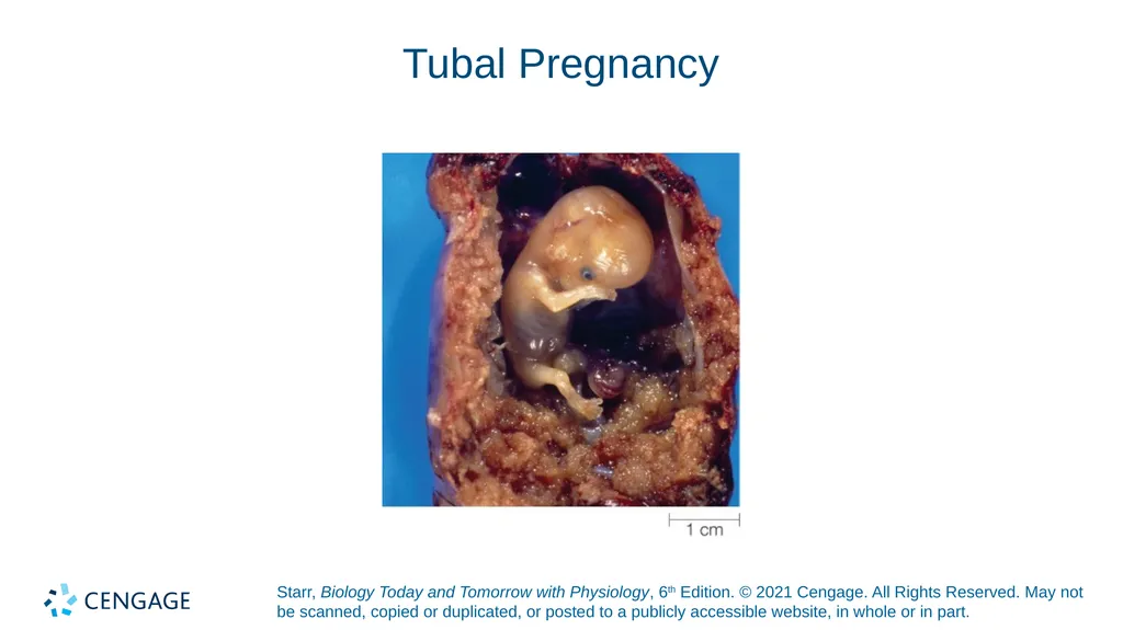 Chapter 27 Animal Reproduction and Development - slide 54 of 58
