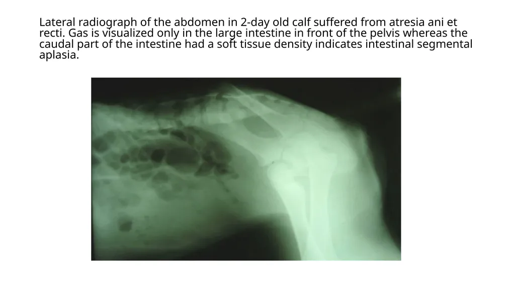 UNIT-5 (REGIONAL SURGERY-II) Rectal prolapse, - slide 17 of 34