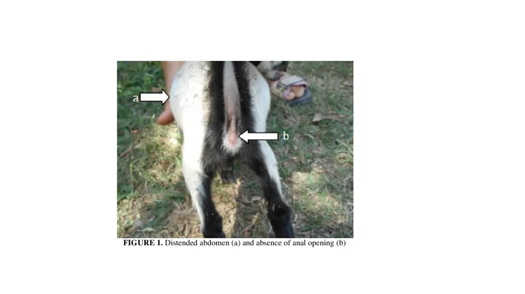 UNIT-5 (REGIONAL SURGERY-II) Rectal prolapse, - slide 34 of 34
