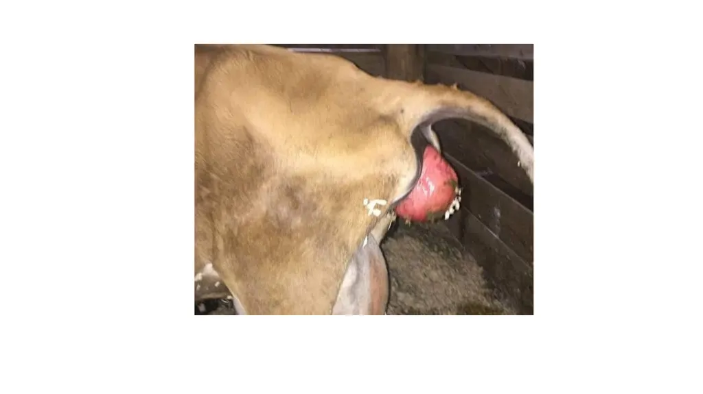 UNIT-5 (REGIONAL SURGERY-II) Rectal prolapse, - slide 4 of 34