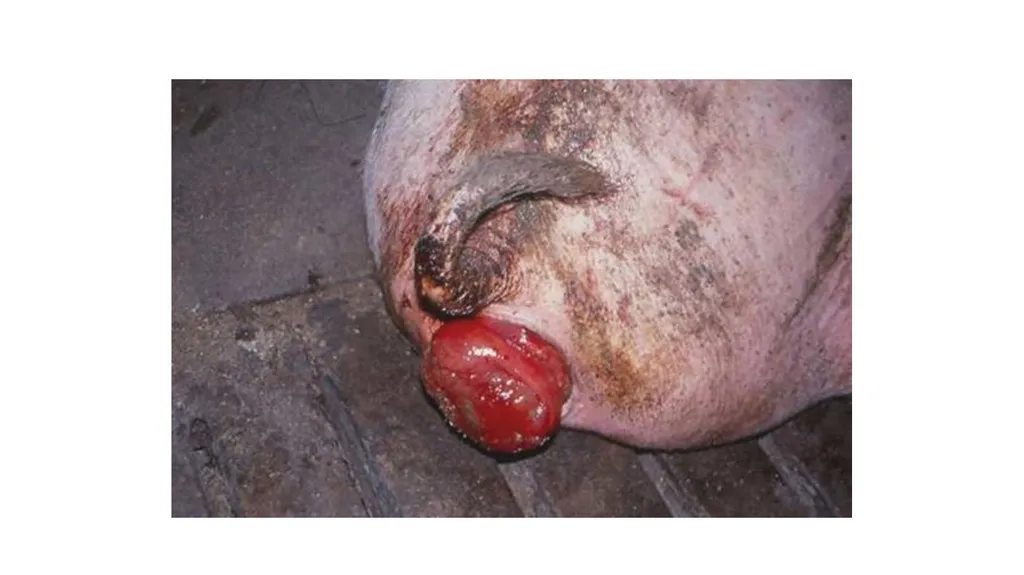UNIT-5 (REGIONAL SURGERY-II) Rectal prolapse, - slide 5 of 34