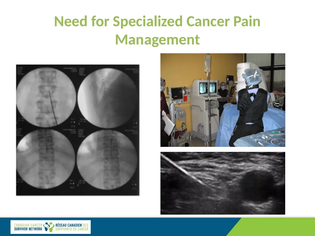 Cancer Pain Management: Specialized Care Dr. David - slide 10 of 12