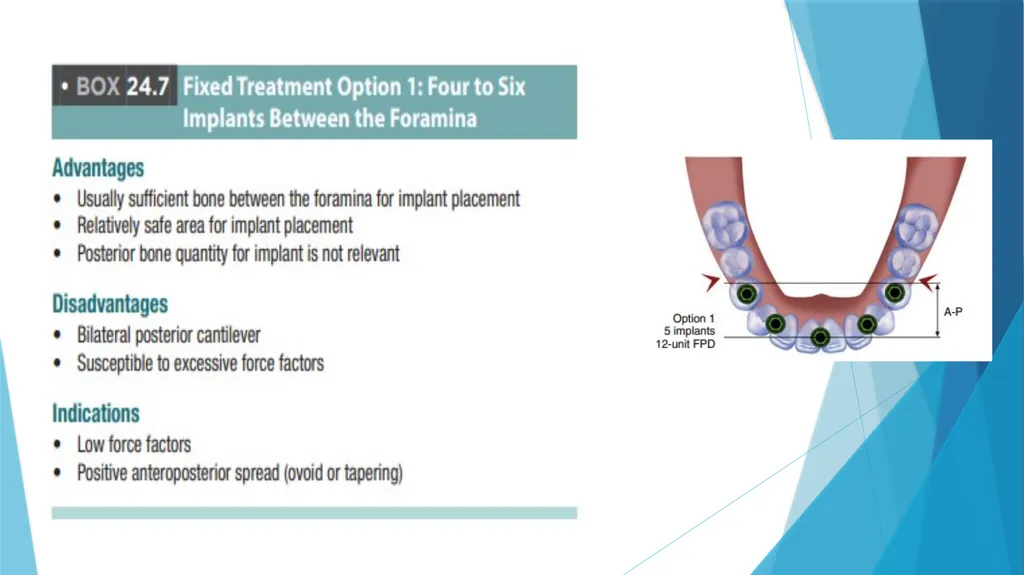 Prosthetic Options in Implant Dentistry Guided By - slide 34 of 53