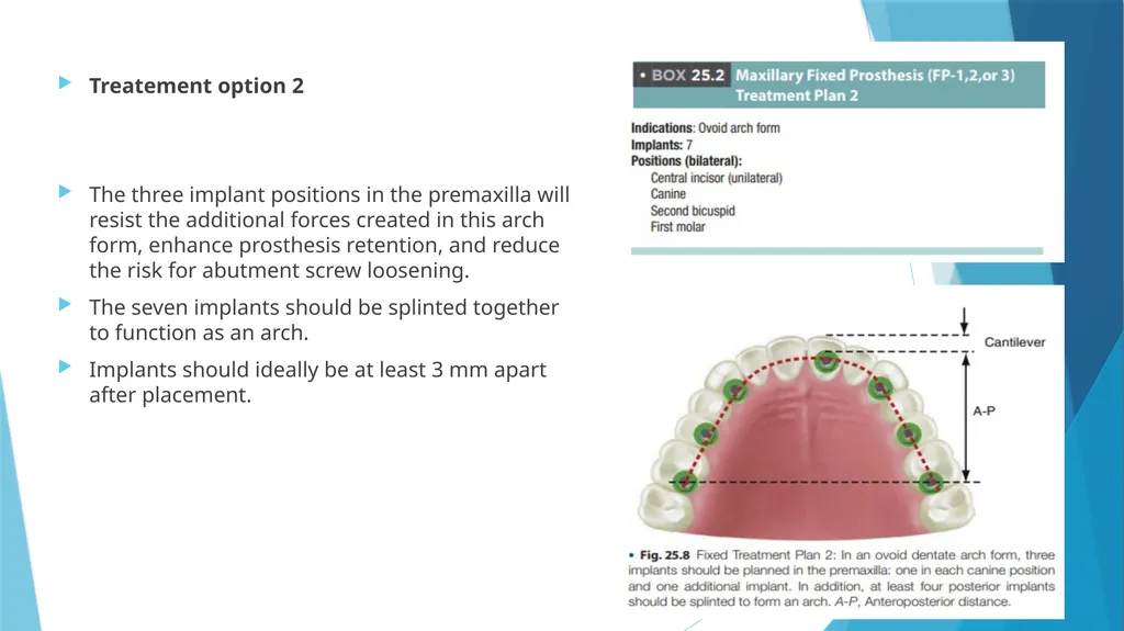 Prosthetic Options in Implant Dentistry Guided By - slide 48 of 53
