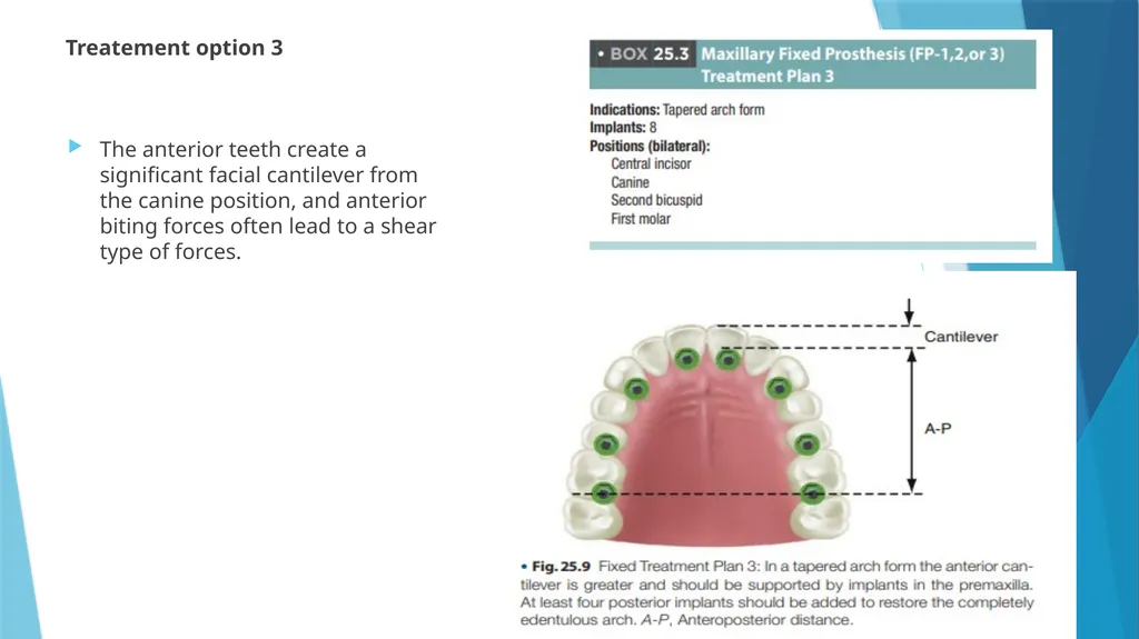Prosthetic Options in Implant Dentistry Guided By - slide 49 of 53