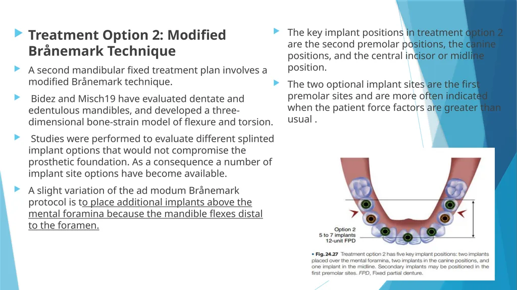 Prosthetic Options in Implant Dentistry Guided By - slide 36 of 53