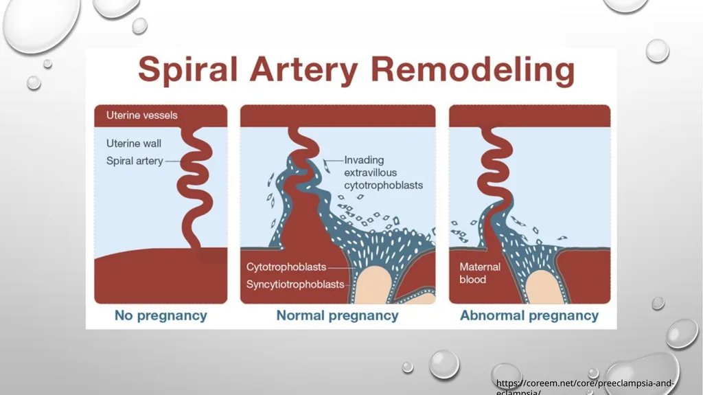 Anesthetic Considerations for Patients with - slide 5 of 28