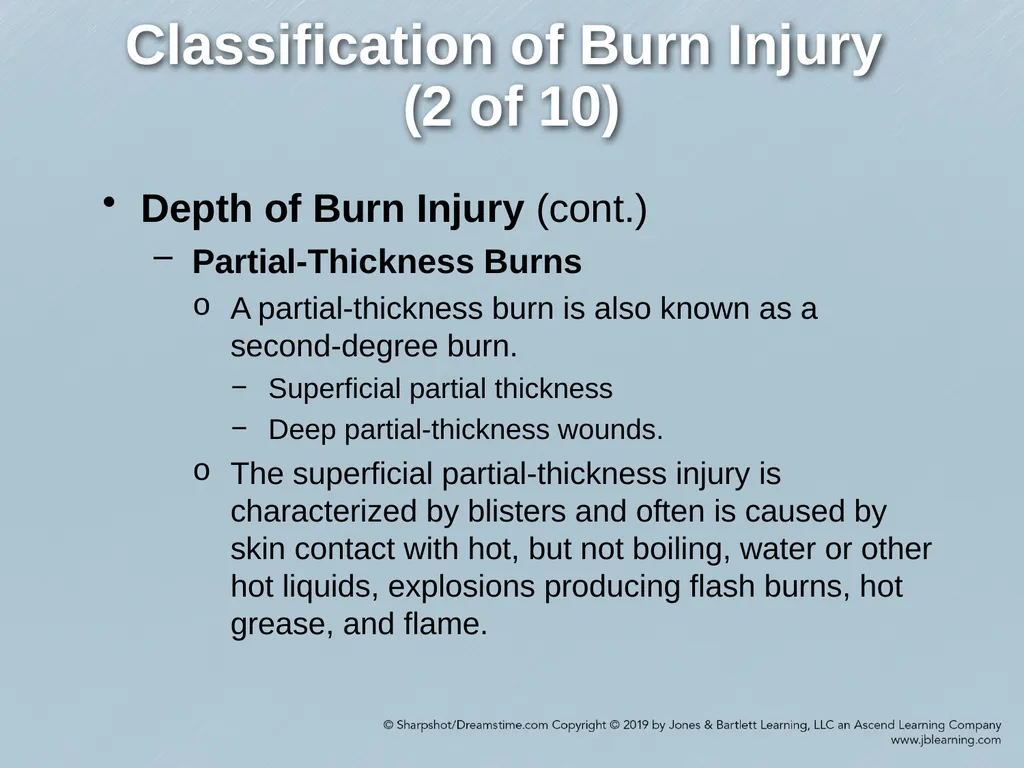 Chapter 38 Burns Comprehensive Lecture National - slide 10 of 59