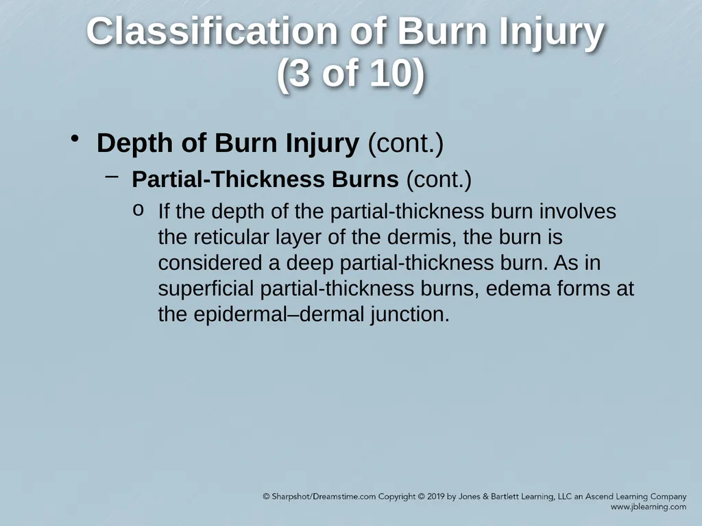 Chapter 38 Burns Comprehensive Lecture National - slide 11 of 59