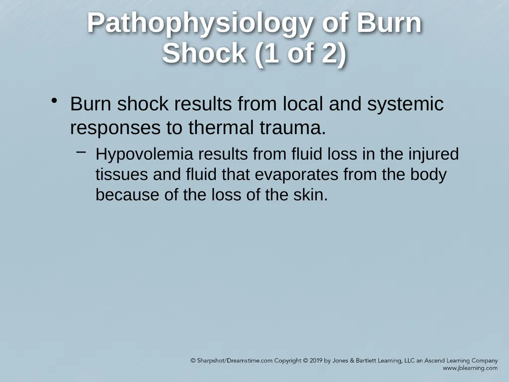 Chapter 38 Burns Comprehensive Lecture National - slide 19 of 59