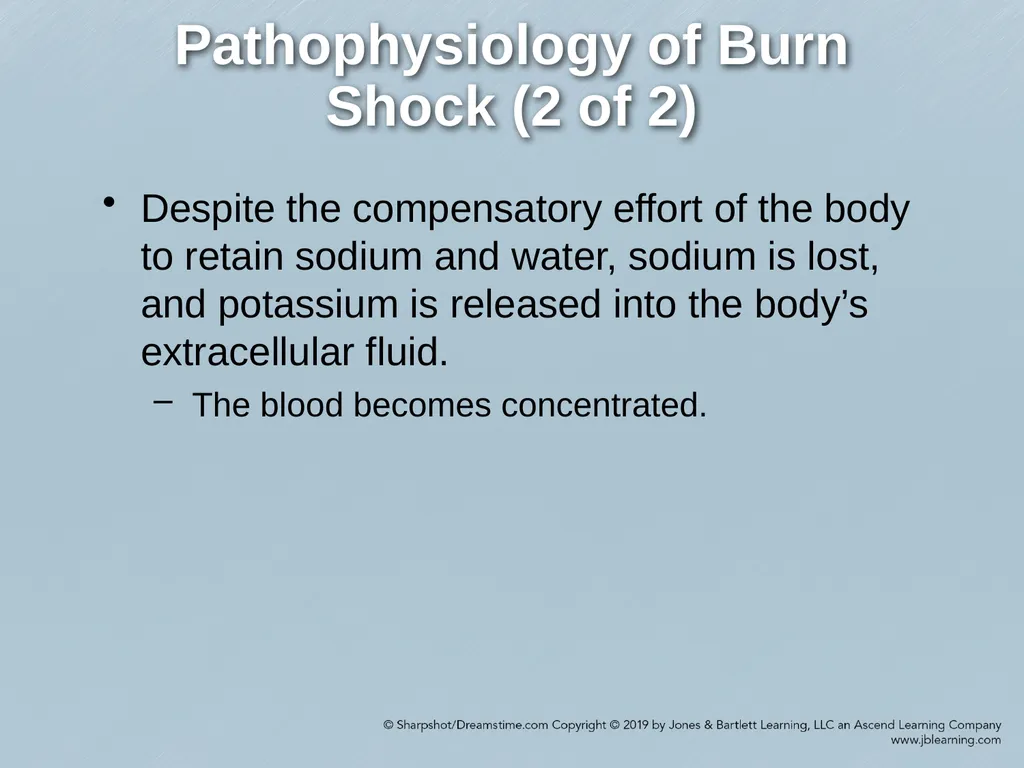 Chapter 38 Burns Comprehensive Lecture National - slide 20 of 59