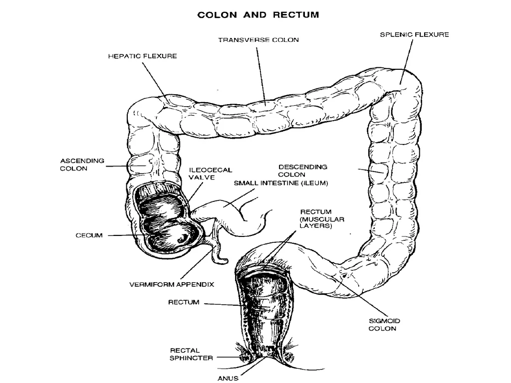 SUR 111 Tracheotomy/Tracheostomy Appendectomy - slide 19 of 28