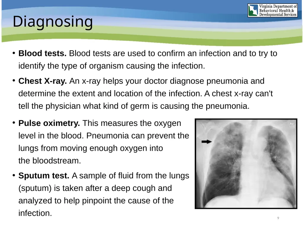 Aspiration Pneumonia Risk Awareness Training (RAT) - slide 9 of 26