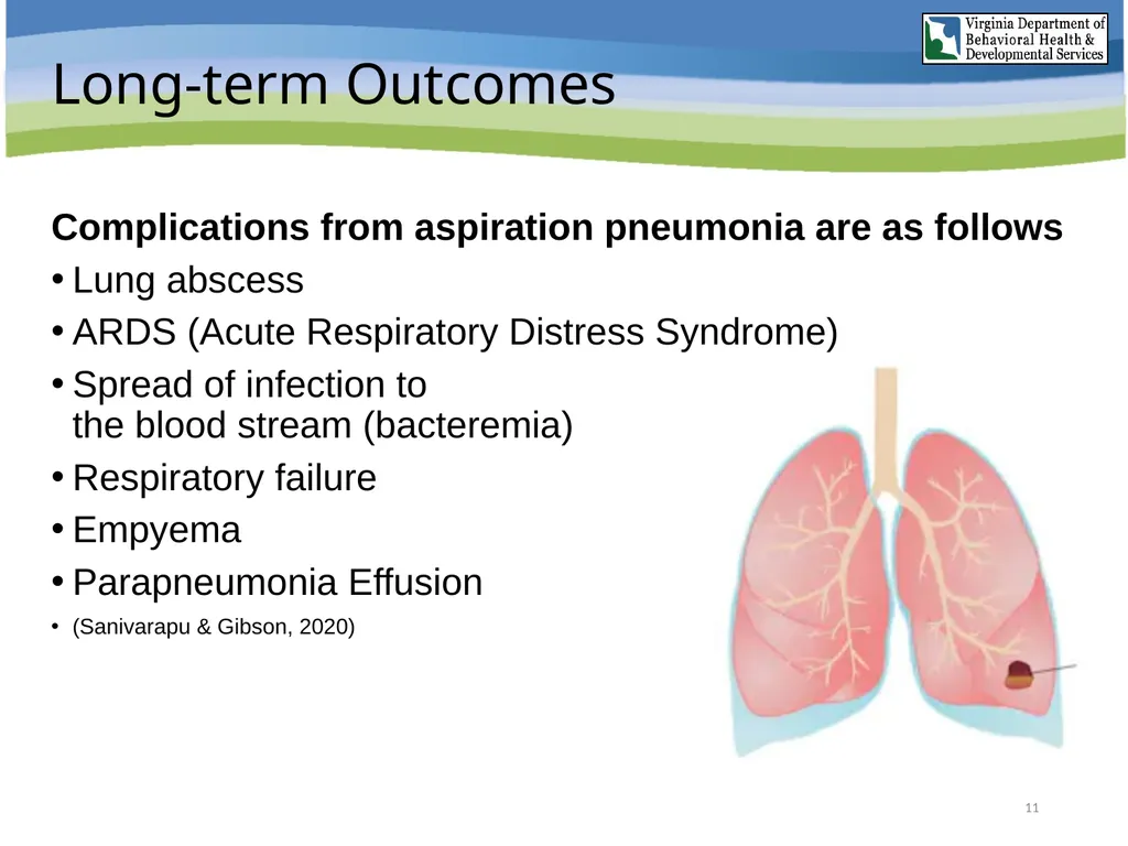 Aspiration Pneumonia Risk Awareness Training (RAT) - slide 11 of 26