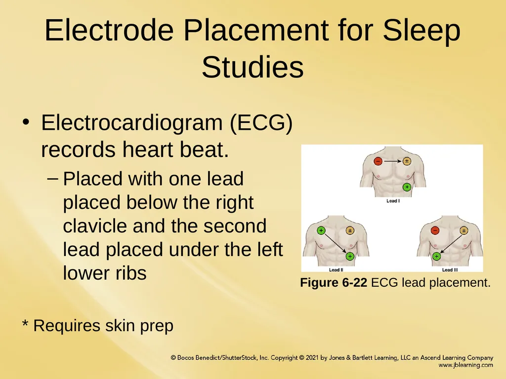 Chapter 6 Patient Hookup Procedures Chapter - slide 11 of 18