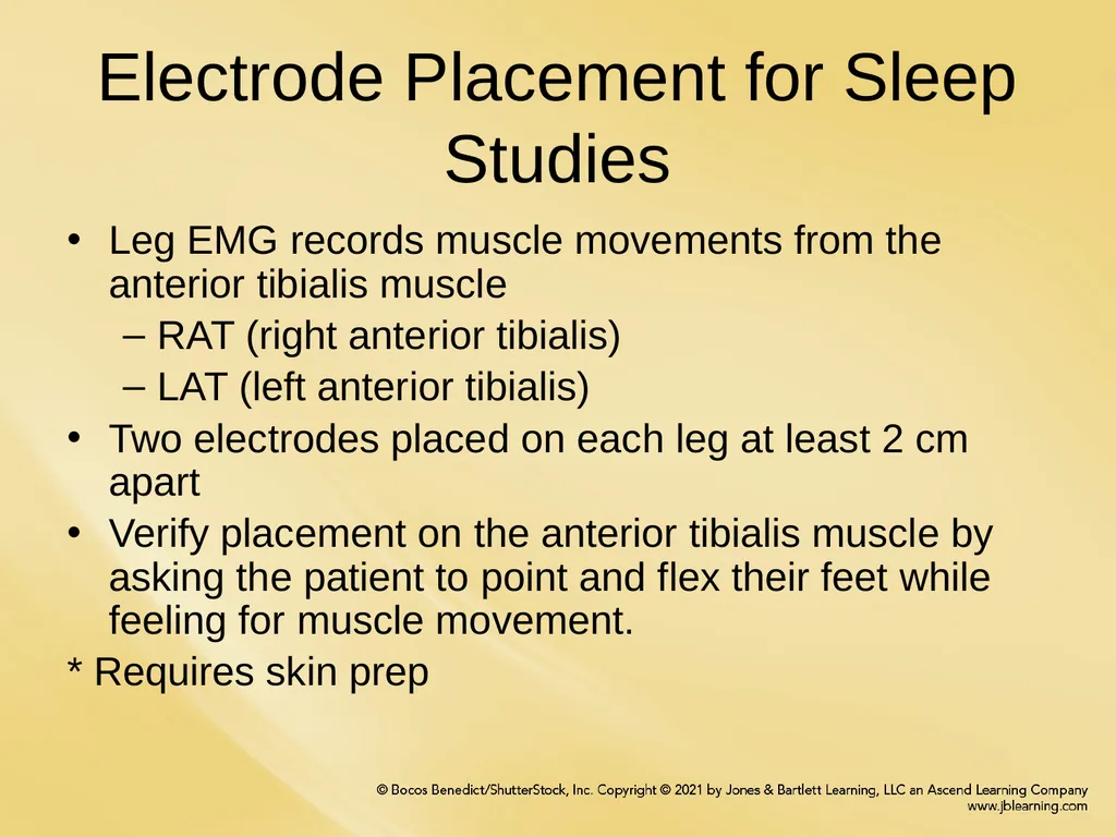 Chapter 6 Patient Hookup Procedures Chapter - slide 12 of 18