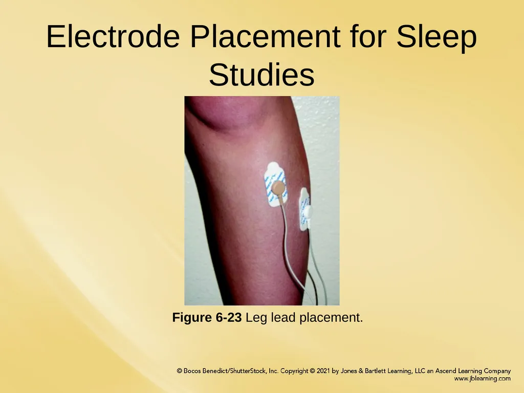 Chapter 6 Patient Hookup Procedures Chapter - slide 13 of 18