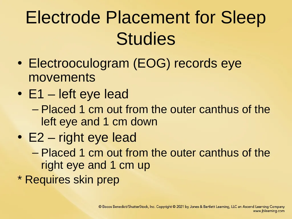 Chapter 6 Patient Hookup Procedures Chapter - slide 5 of 18