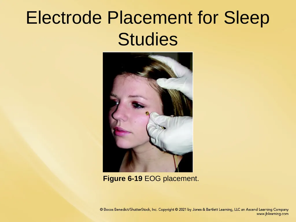 Chapter 6 Patient Hookup Procedures Chapter - slide 6 of 18