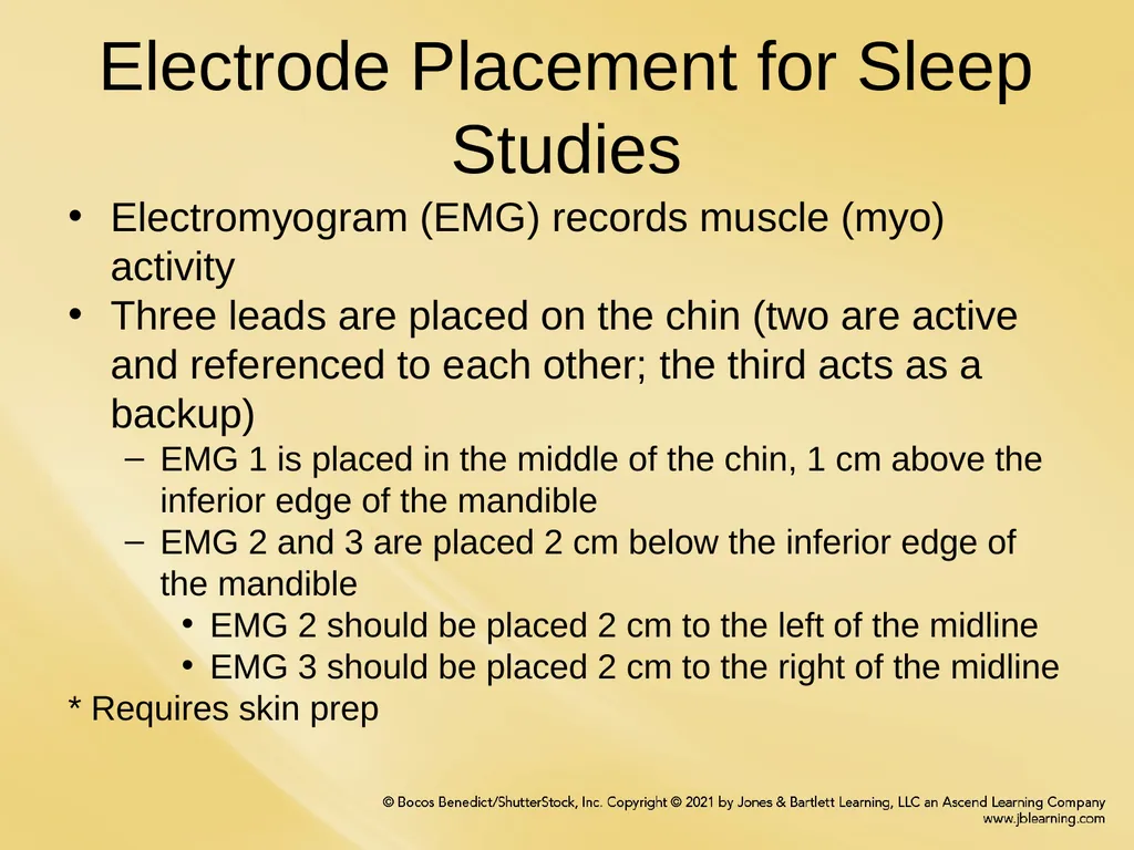 Chapter 6 Patient Hookup Procedures Chapter - slide 7 of 18