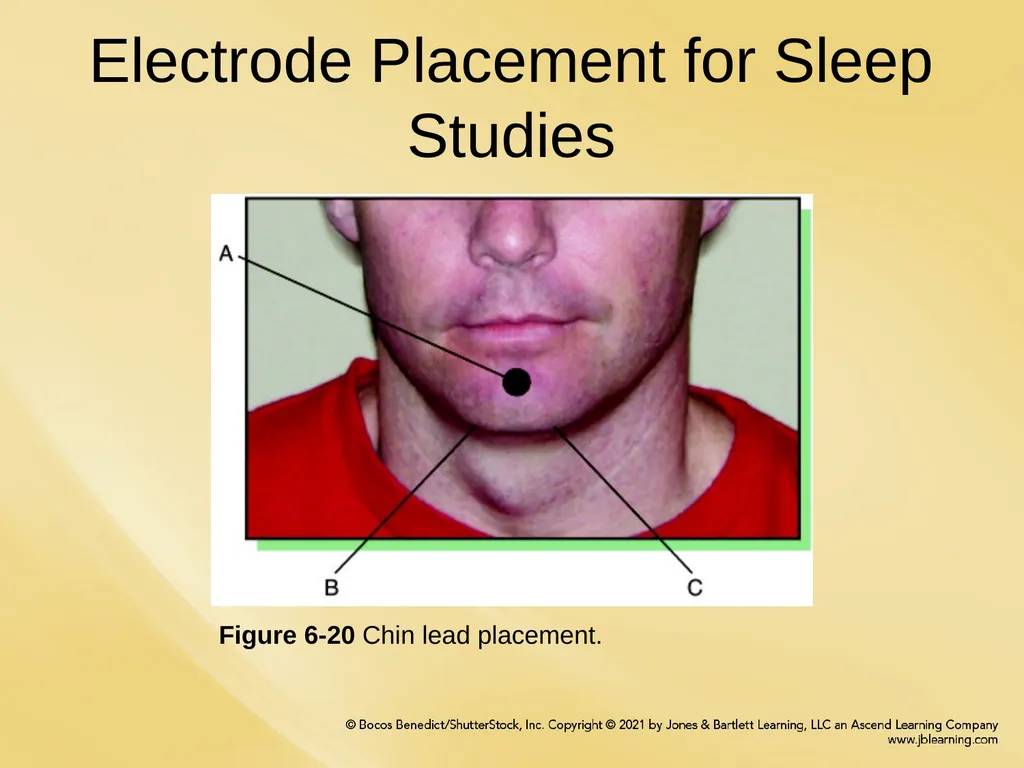 Chapter 6 Patient Hookup Procedures Chapter - slide 8 of 18