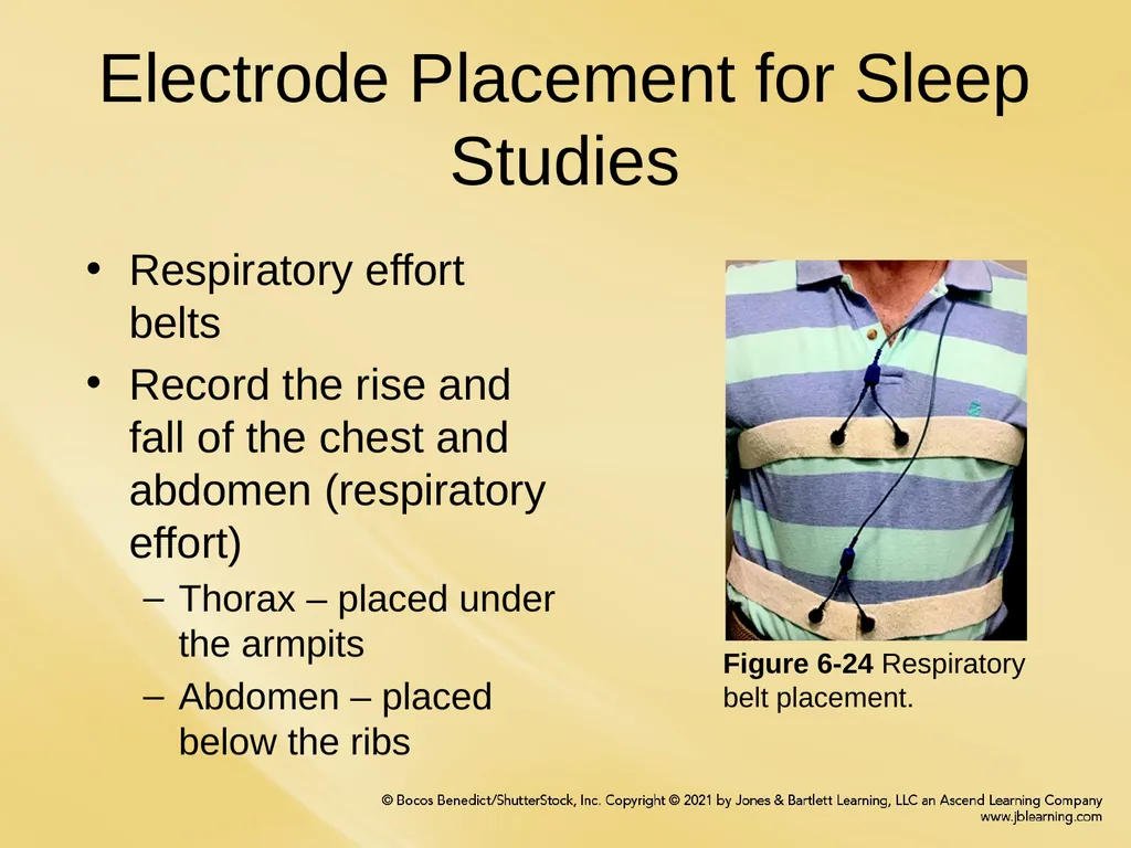 Chapter 6 Patient Hookup Procedures Chapter - slide 14 of 18