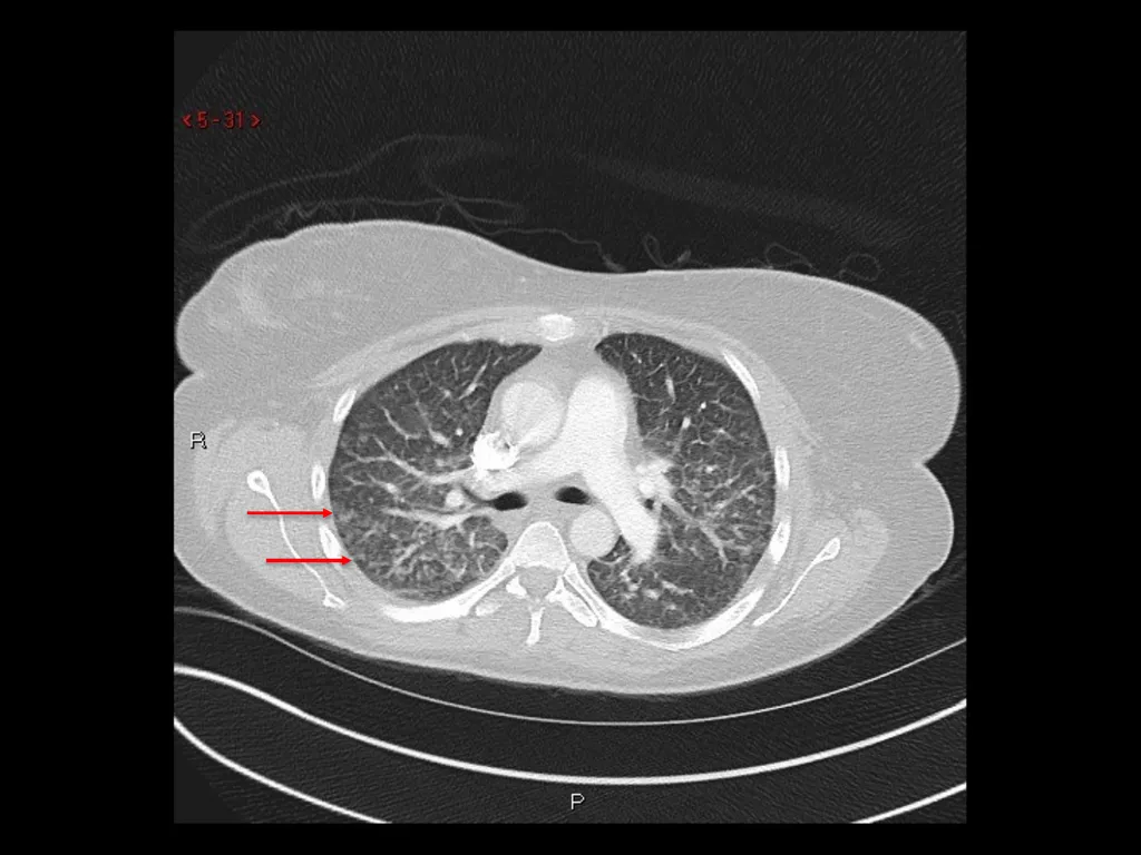 Radiology Case Presentation Sami Natour, MS4 UVA - slide 5 of 9