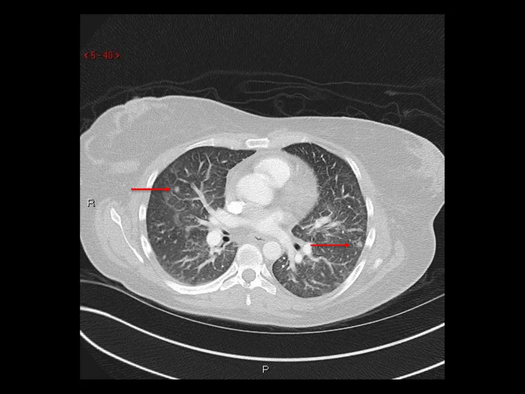 Radiology Case Presentation Sami Natour, MS4 UVA - slide 6 of 9