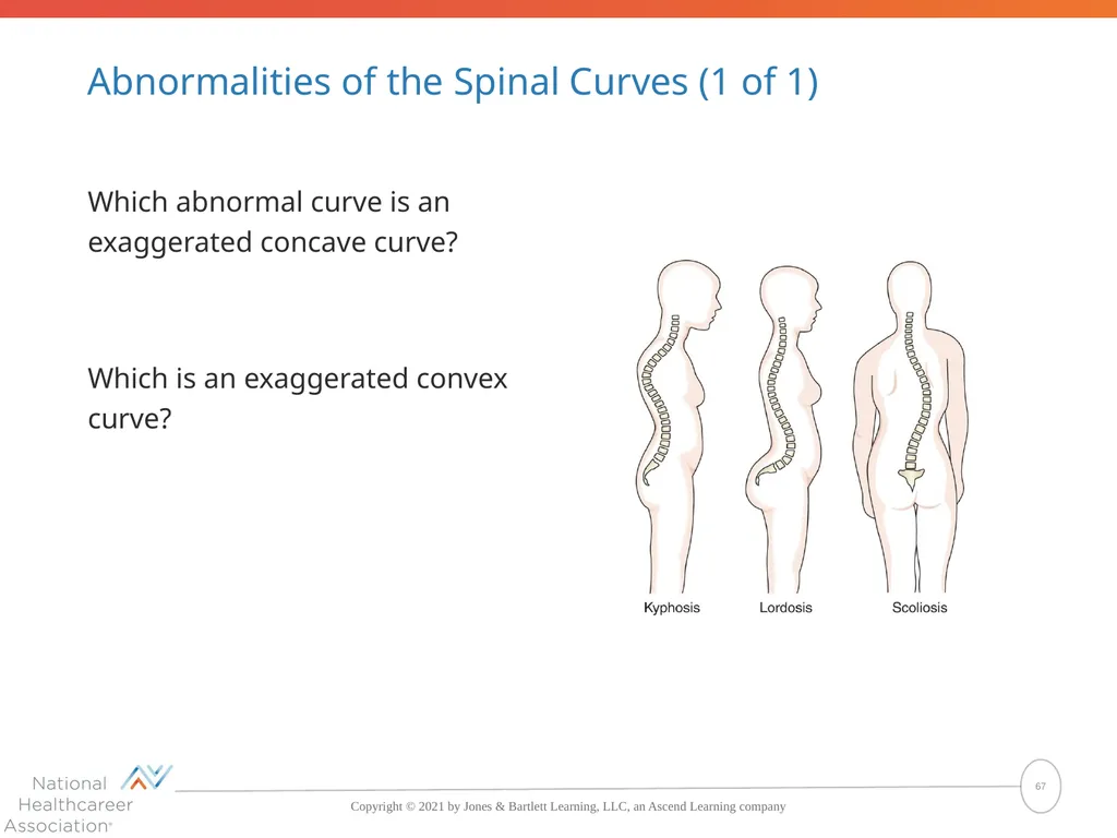 The Skeletal System: Bones and Joints Copyright © - slide 67 of 88