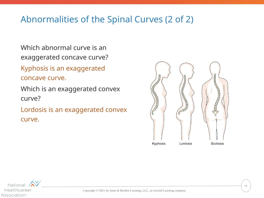 The Skeletal System: Bones and Joints Copyright © - slide 68 of 88