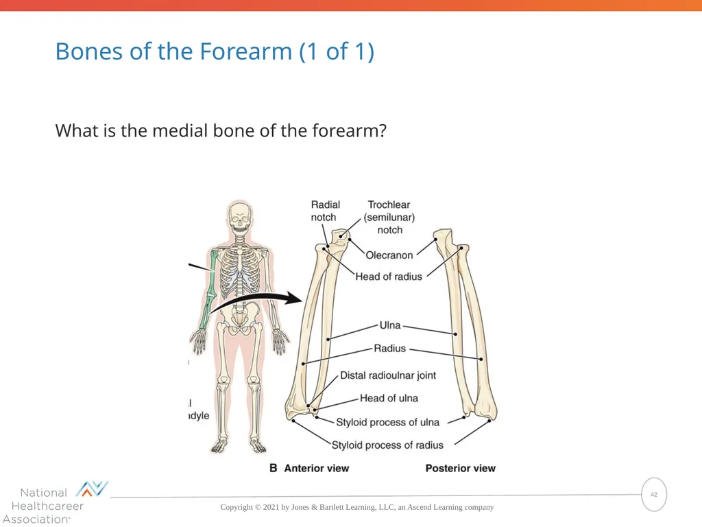 The Skeletal System: Bones and Joints Copyright © - slide 42 of 88