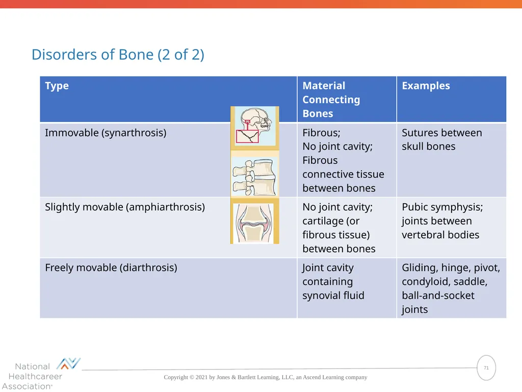 The Skeletal System: Bones and Joints Copyright © - slide 71 of 88